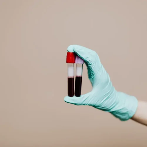 Erro grave: falso positivo em exame toxicológico
